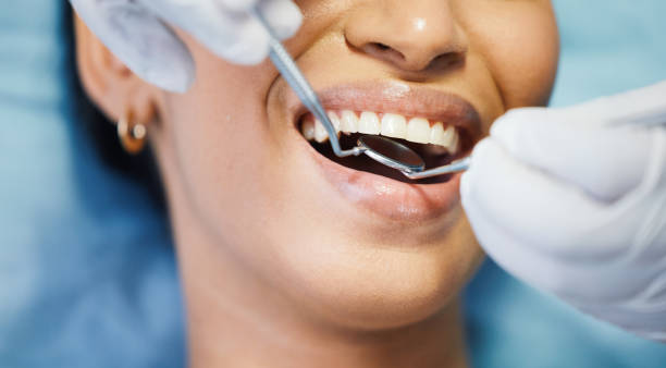 Best Emergency Wisdom Teeth Removal in Mbria, CA