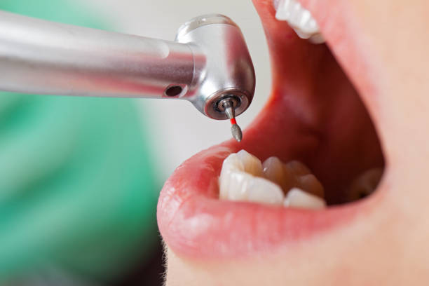 Best Pediatric Emergency Dentist in Mbria, CA